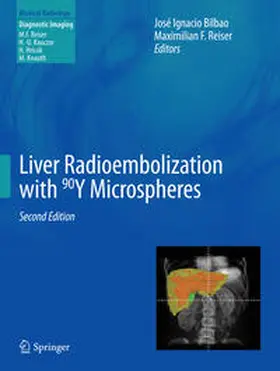 Bilbao / Reiser |  Liver Radioembolization with 90Y Microspheres | Buch |  Sack Fachmedien