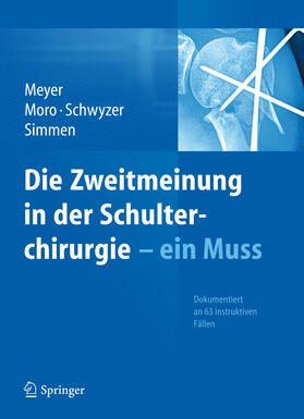 Meyer / Moro / Schwyzer | Die Zweitmeinung in der Schulterchirurgie - ein Muss | E-Book | sack.de