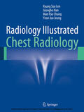 Lee / Han / Chung |  Radiology Illustrated: Chest Radiology | eBook | Sack Fachmedien