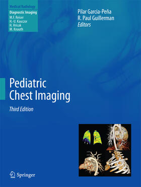 Garcia-Peña / Guillerman | Pediatric Chest Imaging | E-Book | sack.de