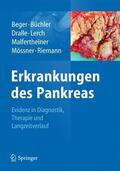 Beger / Büchler / Dralle |  Erkrankungen des Pankreas | Buch |  Sack Fachmedien