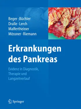 Beger / Büchler / Dralle | Erkrankungen des Pankreas | E-Book | sack.de