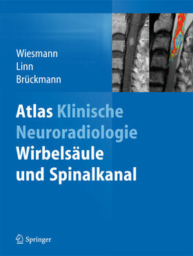 Wiesmann / Linn / Brückmann | Atlas Klinische Neuroradiologie | E-Book | sack.de