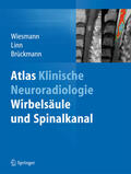 Wiesmann / Linn / Brückmann |  Atlas Klinische Neuroradiologie | eBook | Sack Fachmedien