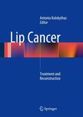 Kolokythas |  Lip Cancer | Buch |  Sack Fachmedien