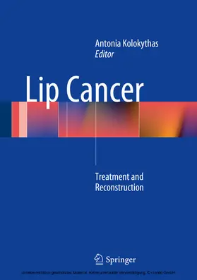 Kolokythas | Lip Cancer | E-Book | www.sack.de