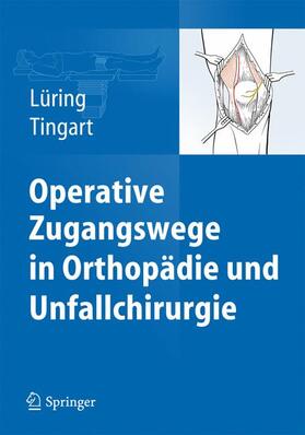 Lüring / Tingart | Operative Zugangswege in Orthopädie und Unfallchirurgie | Buch | 978-3-642-38264-2 | sack.de