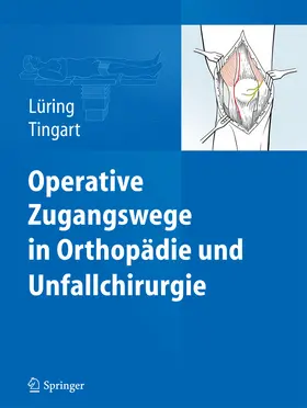 Lüring / Tingart |  Operative Zugangswege in Orthopädie und Unfallchirurgie | eBook | Sack Fachmedien