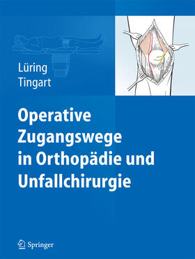 Lüring / Tingart | Operative Zugangswege in Orthopädie und Unfallchirurgie | E-Book | sack.de