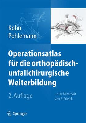 Kohn / Pohlemann | Kohn, D: Operationsatlas/orthopäd.-unfallchir. Weiterbildung | Buch | 978-3-642-38420-2 | sack.de