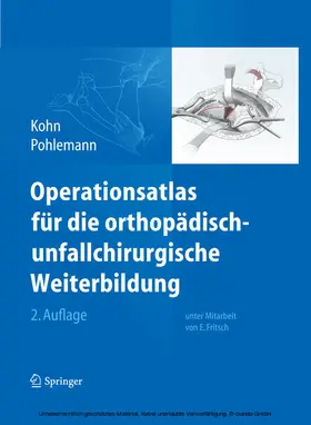 Kohn / Pohlemann | Operationsatlas für die orthopädisch-unfallchirurgische Weiterbildung | E-Book | www.sack.de
