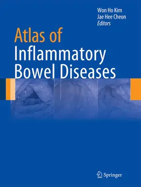 Cheon / Kim |  Atlas of Inflammatory Bowel Diseases | Buch |  Sack Fachmedien