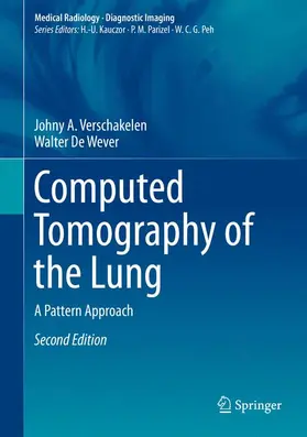 De Wever / Verschakelen | Computed Tomography of the Lung | Buch | 978-3-642-39517-8 | sack.de