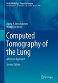 De Wever / Verschakelen |  Computed Tomography of the Lung | Buch |  Sack Fachmedien