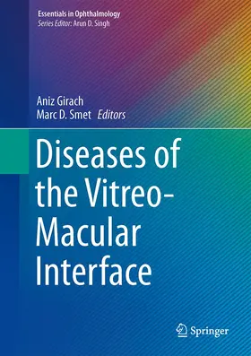 Girach / de Smet |  Diseases of the Vitreo-Macular Interface | Buch |  Sack Fachmedien