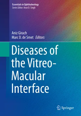 Girach / De Smet |  Diseases of the Vitreo-Macular Interface | eBook | Sack Fachmedien