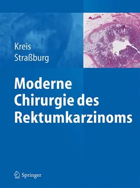 Straßburg / Kreis |  Moderne Chirurgie des Rektumkarzinoms | Buch |  Sack Fachmedien