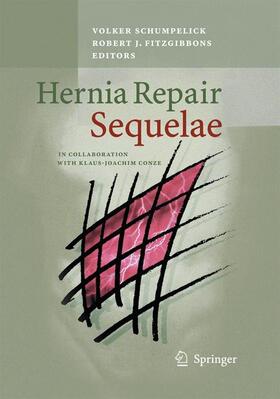Fitzgibbons / Schumpelick | Hernia Repair Sequelae | Buch | 978-3-642-42372-7 | sack.de