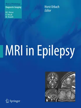 Urbach |  MRI in Epilepsy | Buch |  Sack Fachmedien