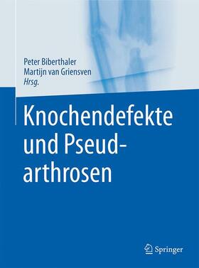 van Griensven / Biberthaler | Knochendefekte und Pseudarthrosen | Buch | 978-3-642-44990-1 | sack.de