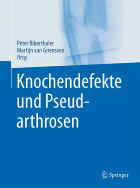 Biberthaler / van Griensven / Delhey |  Knochendefekte und Pseudarthrosen | eBook | Sack Fachmedien