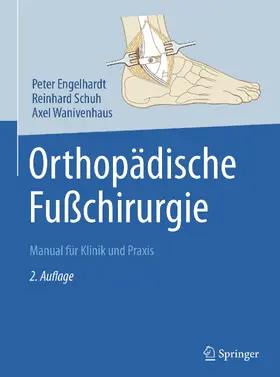 Engelhardt / Schuh / Wanivenhaus |  Orthopädische Fußchirurgie | eBook | Sack Fachmedien