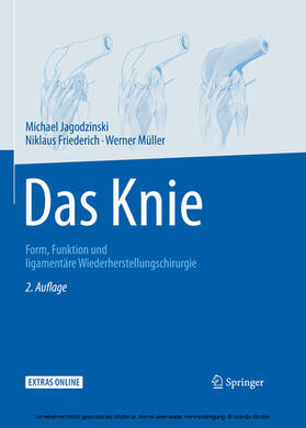 Jagodzinski / Friederich / Müller | Das Knie | E-Book | sack.de