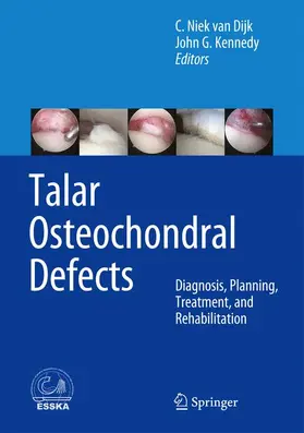 van Dijk / Kennedy |  Talar Osteochondral Defects | Buch |  Sack Fachmedien