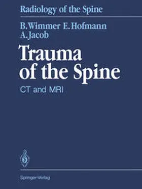 Wimmer / Hofmann / Jacob |  Trauma of the Spine | eBook | Sack Fachmedien