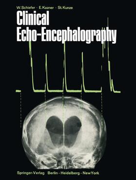 Schiefer / Kazner / Kunze | Clinical Echo-Encephalography | Buch | 978-3-642-48723-1 | sack.de