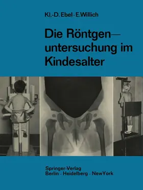 Ebel / Willich |  Die Röntgenuntersuchung im Kindesalter | Buch |  Sack Fachmedien
