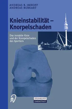 Burkart / Imhoff |  Knieinstabilität und Knorpelschaden | Buch |  Sack Fachmedien