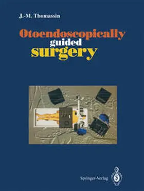 Thomassin | Otoendoscopically guided surgery | E-Book | www.sack.de