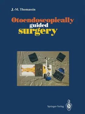 Thomassin |  Otoendoscopically guided surgery | Buch |  Sack Fachmedien