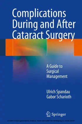 Spandau / Scharioth |  Complications During and After Cataract Surgery | eBook | Sack Fachmedien