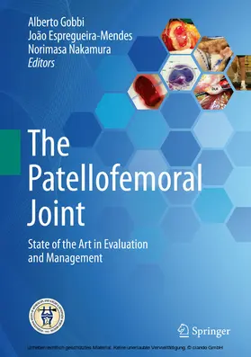 Gobbi / Espregueira-Mendes / Nakamura |  The Patellofemoral Joint | eBook | Sack Fachmedien