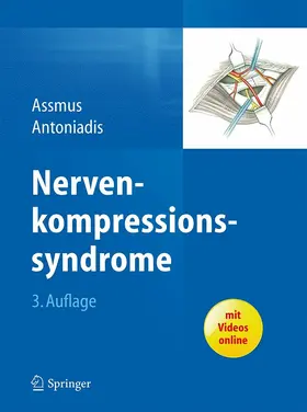Assmus / Antoniadis |  Nervenkompressionssyndrome | eBook | Sack Fachmedien