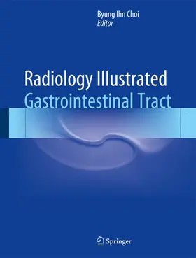 Choi | Radiology Illustrated: Gastrointestinal Tract | Buch | 978-3-642-55411-7 | www.sack.de