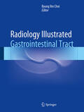 Choi |  Radiology Illustrated: Gastrointestinal Tract | eBook | Sack Fachmedien