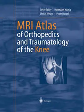 Teller / König / Weber | MRI Atlas of Orthopedics and Traumatology of the Knee | E-Book | sack.de