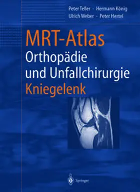 Teller / König / Weber |  MRT-Atlas Orthopädie und Unfallchirurgie | eBook | Sack Fachmedien