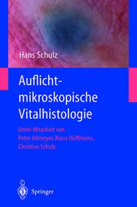Schulz |  Auflichtmikroskopische Vitalhistologie | eBook | Sack Fachmedien