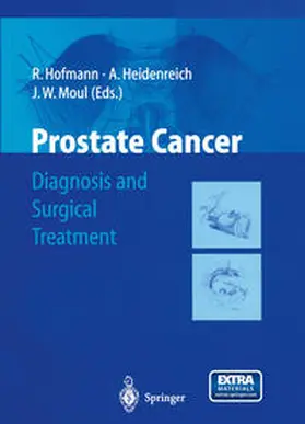 Hofmann / Heidenreich / Moul |  Prostate Cancer | eBook | Sack Fachmedien