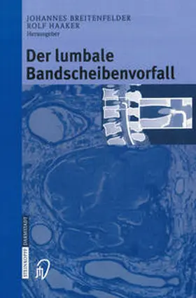 Breitenfelder / Haaker |  Der lumbale Bandscheibenvorfall | eBook | Sack Fachmedien