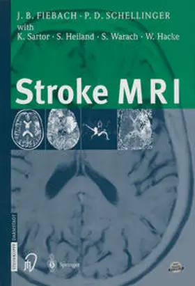 Fiebach / Schellinger |  Stroke MRI | eBook | Sack Fachmedien