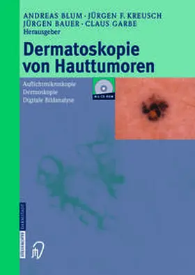Blum / Kreusch / Bauer |  Dermatoskopie von Hauttumoren | eBook | Sack Fachmedien
