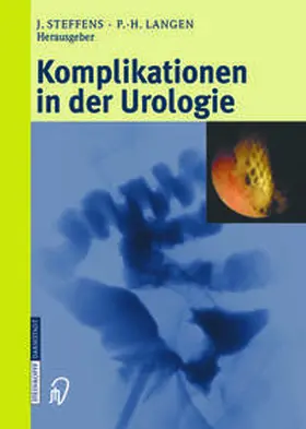 Steffens / Langen | Komplikationen in der Urologie | E-Book | www.sack.de