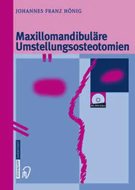Hönig | Maxillomandibuläre Umstellungsosteotomien | E-Book | sack.de
