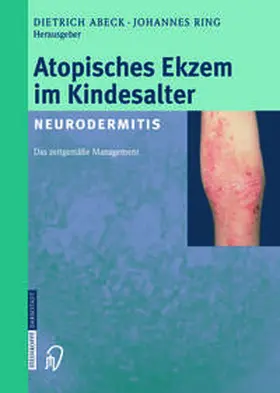 Abeck / Ring |  Atopisches Ekzem im Kindesalter (Neurodermitis) | eBook | Sack Fachmedien