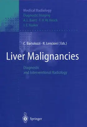 Bartolozzi / Lencioni | Liver Malignancies | E-Book | www.sack.de